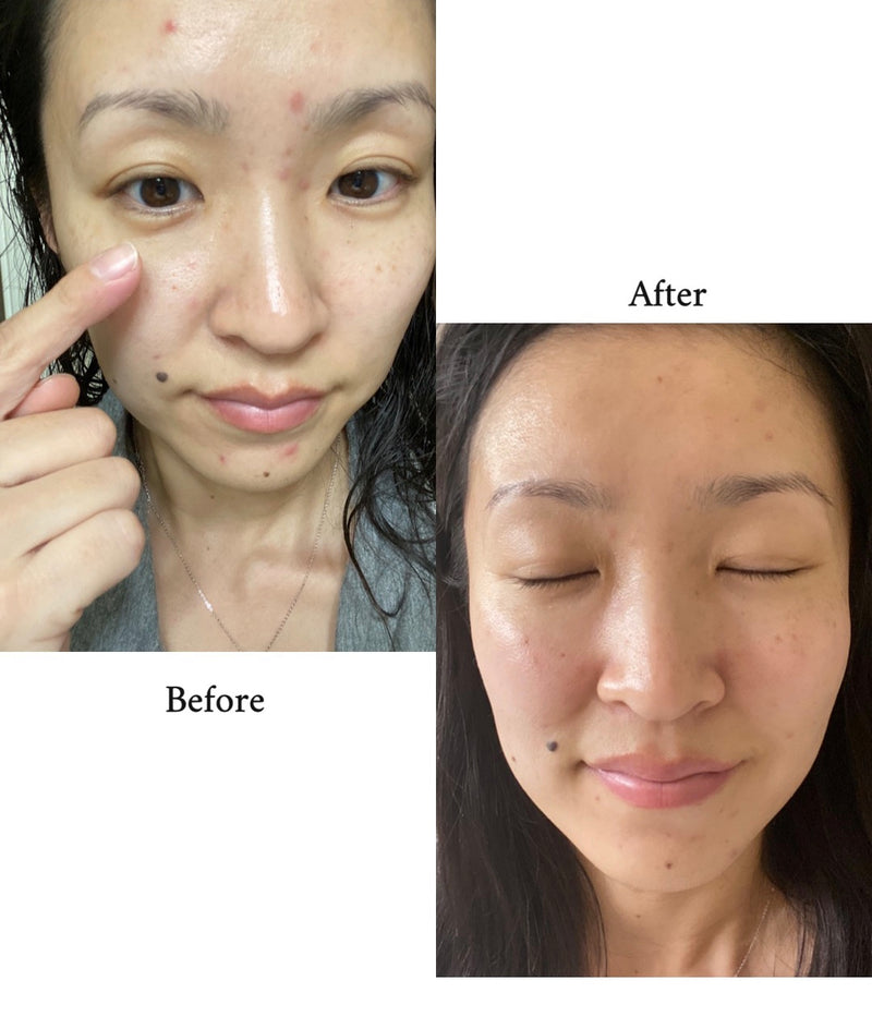 How I HEALED my damaged skin barrier with K-Beauty! - Olive Kollection