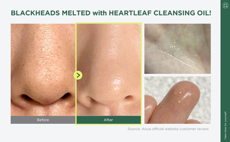 Anua Heartleaf Pore Control Cleansing Oil - Olive Kollection